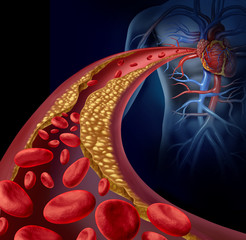 Cholesterin beeinflusst die Herzfunktion